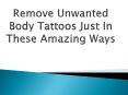 Remove Unwanted Body Tattoos Just In These Amazing Ways PowerPoint PPT Presentation