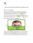 Best Hair Transplant Clinic-Rootz Hir clinic PowerPoint PPT Presentation
