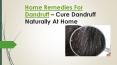 Home Remedies For Dandruff - Causes, Symptoms and Prevention PowerPoint PPT Presentation