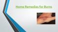 Home Remedies For burns - How to Treat Burns Naturally at Home PowerPoint PPT Presentation