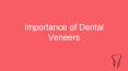 Importance of Dental Veneers PowerPoint PPT Presentation