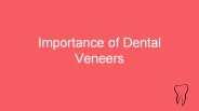 Importance of Dental Veneers