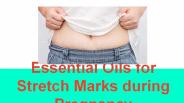 Natural Essential Oils for stretch marks during pregnancy