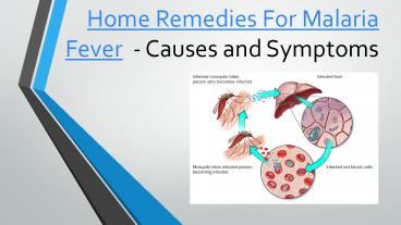 Malaria Fever: Home Remedies, Causes, Symptoms, and Prevention Tips