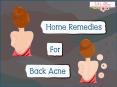 Home Remedies For Back Acne PowerPoint PPT Presentation
