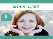 Lingual Orthodontic Treatment In Lebanon