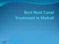 Best Root Canal Treatment in Mohali (1) PowerPoint PPT Presentation