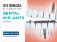 Tips To Reduce The Cost of Dental Implants - Mosmandentalclinic.com.au PowerPoint PPT Presentation