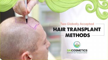 Prime Globally Accepted Hair Transplant Methods