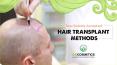 Prime Globally Accepted Hair Transplant Methods PowerPoint PPT Presentation