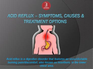 Acid Reflux – Symptoms, Causes & Treatment Options