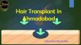 Hair Transplant in Ahmadabad PowerPoint PPT Presentation