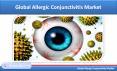 Allergic Conjunctivitis Market is expected to be more than USD 2 Billion market by 2025 PowerPoint PPT Presentation