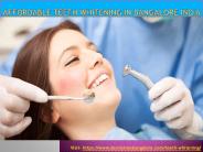 Affordable Teeth Whitening in Bangalore India