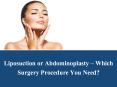 Liposuction or Abdominoplasty – Which Surgery Procedure You Need? PowerPoint PPT Presentation