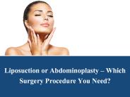 Liposuction or Abdominoplasty – Which Surgery Procedure You Need?