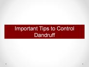 Important Tips to Control Dandruff