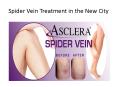 Spider Vein Treatment USA PowerPoint PPT Presentation