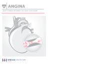 Angina - What stands between you and your heart