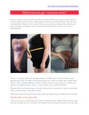 Will Everyone Get Varicose Veins?