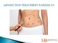 Affordable Liposuction Treatment Parker Co | Autumn Stone MD Aesthetics PowerPoint PPT Presentation