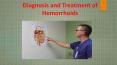 Best Hemorrhoid Treatment PowerPoint PPT Presentation