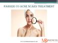 Parker Co Acne Scars Treatment | Autumn Stone MD Aesthetics PowerPoint PPT Presentation