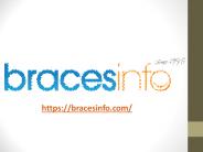 Invisalign Braces Review