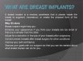 What is Breast Implants Surgery? PowerPoint PPT Presentation