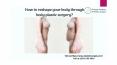 Body plastic surgery clinic in chicago PowerPoint PPT Presentation