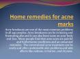 Home Remedies for Acne Marks PowerPoint PPT Presentation