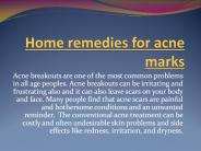Home Remedies for Acne Marks