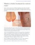 Varicose Veins Laser Treatment in Hyderabad PowerPoint PPT Presentation