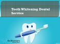 Teeth Whitening Services in Mohali PowerPoint PPT Presentation