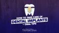 How To Take Care Of Dental Implants—Oral Tips PowerPoint PPT Presentation