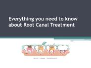 Everything you need to know about Root Canal Treatment