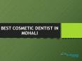 Best Cosmetic Dentist in Mohali PowerPoint PPT Presentation