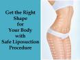 Get the Right Shape for Your Body with Safe Liposuction Procedure PowerPoint PPT Presentation