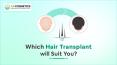 Which Type of Hair Transplant Procedures Suits You? PowerPoint PPT Presentation