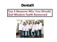 Top 5 Reasons Why You Should Get Wisdom Teeth Removed PowerPoint PPT Presentation