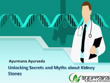 Unlocking Secrets and Myths about Kidney Stones