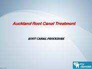 Root Canal Treatment in Auckland