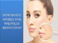 HOW BOTOX WORKS FOR WRINKLE REDUCTION PowerPoint PPT Presentation