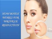 HOW BOTOX WORKS FOR WRINKLE REDUCTION