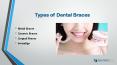 Types of Dental Braces | Invisalign Treatment in Chino Hills CA PowerPoint PPT Presentation