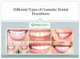 Cosmetic Dental Treatment PowerPoint PPT Presentation