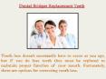 Dental bridges replacement teeth PowerPoint PPT Presentation