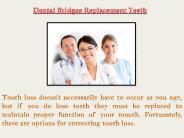 Dental bridges replacement teeth