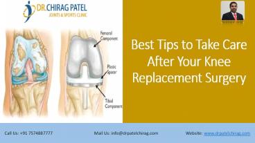 Best Tips to Take Care After Your Knee Replacement Surgery | Dr Chirag Patel