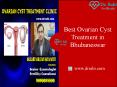 Ovarian Cyst Treatment PowerPoint PPT Presentation